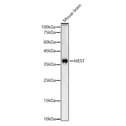 Western Blot - Anti-MEST Antibody (A15433) - Antibodies.com