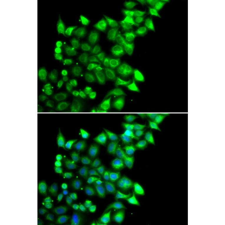 Immunofluorescence - Anti-MEST Antibody (A15433) - Antibodies.com