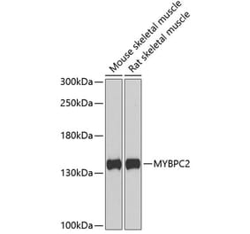 Western Blot - Anti-fast skeletal Myosin Antibody (A15434) - Antibodies.com