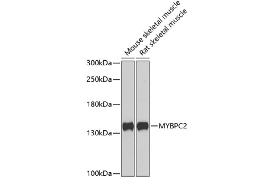 Western Blot - Anti-fast skeletal Myosin Antibody (A15434) - Antibodies.com