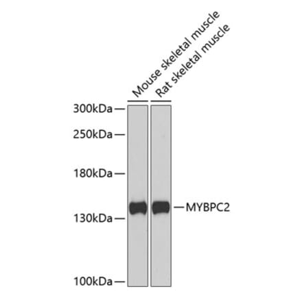 Western Blot - Anti-fast skeletal Myosin Antibody (A15434) - Antibodies.com