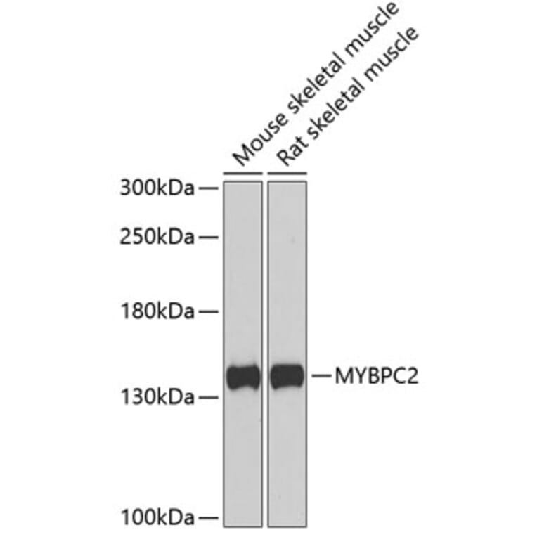 Western Blot - Anti-fast skeletal Myosin Antibody (A15434) - Antibodies.com