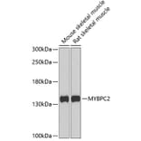 Western Blot - Anti-fast skeletal Myosin Antibody (A15434) - Antibodies.com
