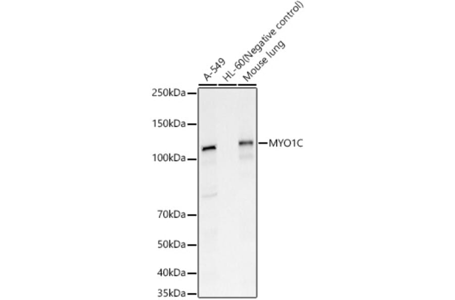 Western Blot - Anti-MYO1C Antibody (A15436) - Antibodies.com