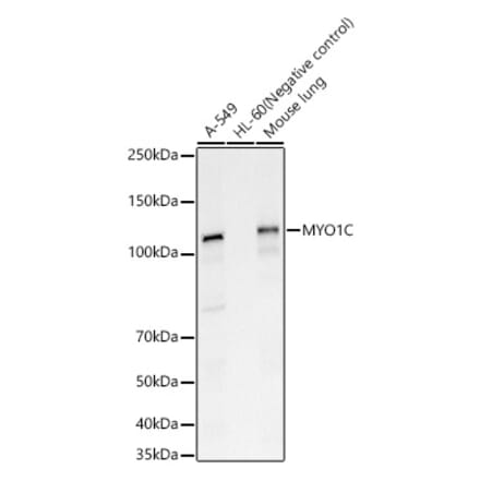 Western Blot - Anti-MYO1C Antibody (A15436) - Antibodies.com