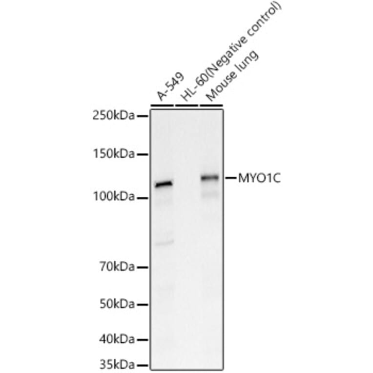 Western Blot - Anti-MYO1C Antibody (A15436) - Antibodies.com