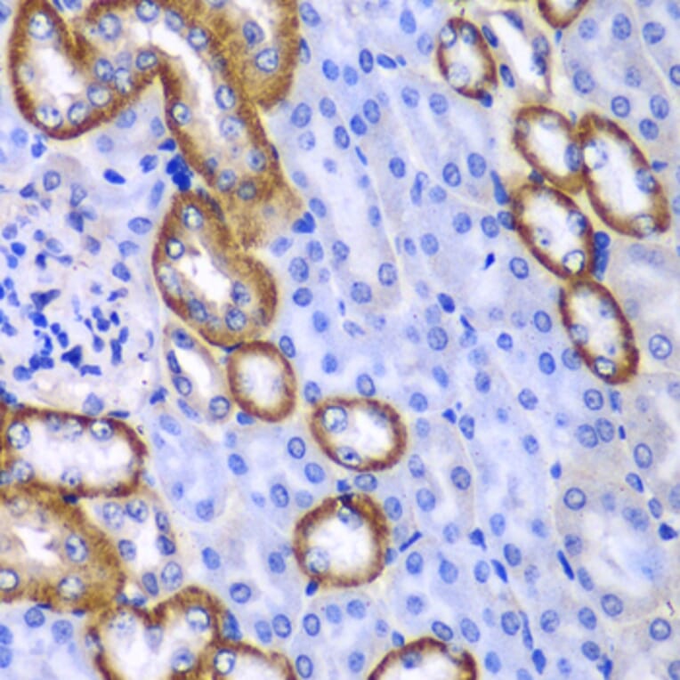 Immunohistochemistry - Anti-MYO1C Antibody (A15436) - Antibodies.com