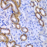 Immunohistochemistry - Anti-MYO1C Antibody (A15436) - Antibodies.com