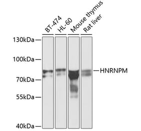 Western Blot - Anti-Heterogeneous nuclear ribonucleoprotein M Antibody (A15437) - Antibodies.com