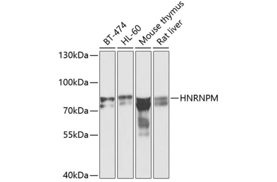 Western Blot - Anti-Heterogeneous nuclear ribonucleoprotein M Antibody (A15437) - Antibodies.com