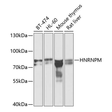 Western Blot - Anti-Heterogeneous nuclear ribonucleoprotein M Antibody (A15437) - Antibodies.com