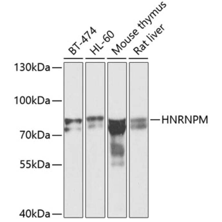 Western Blot - Anti-Heterogeneous nuclear ribonucleoprotein M Antibody (A15437) - Antibodies.com