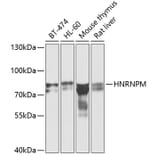 Western Blot - Anti-Heterogeneous nuclear ribonucleoprotein M Antibody (A15437) - Antibodies.com