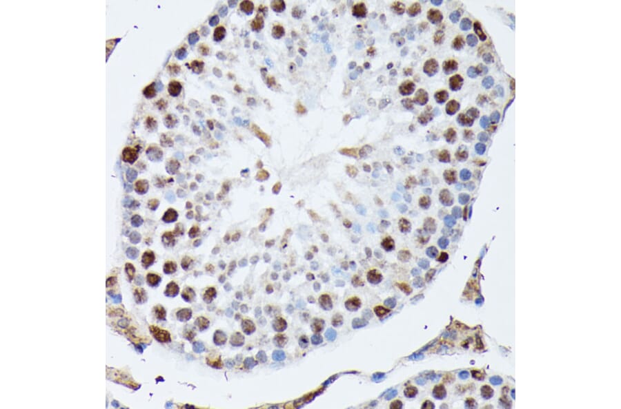 Immunohistochemistry - Anti-Heterogeneous nuclear ribonucleoprotein M Antibody (A15437) - Antibodies.com