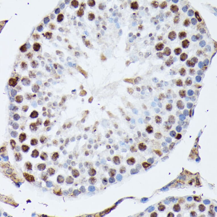 Immunohistochemistry - Anti-Heterogeneous nuclear ribonucleoprotein M Antibody (A15437) - Antibodies.com