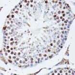 Immunohistochemistry - Anti-Heterogeneous nuclear ribonucleoprotein M Antibody (A15437) - Antibodies.com