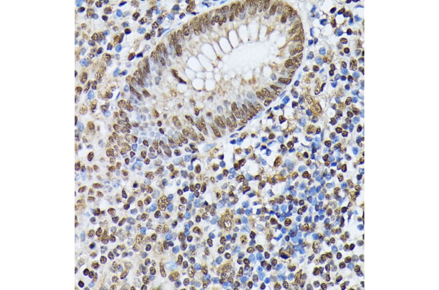 Immunohistochemistry - Anti-Heterogeneous nuclear ribonucleoprotein M Antibody (A15437) - Antibodies.com