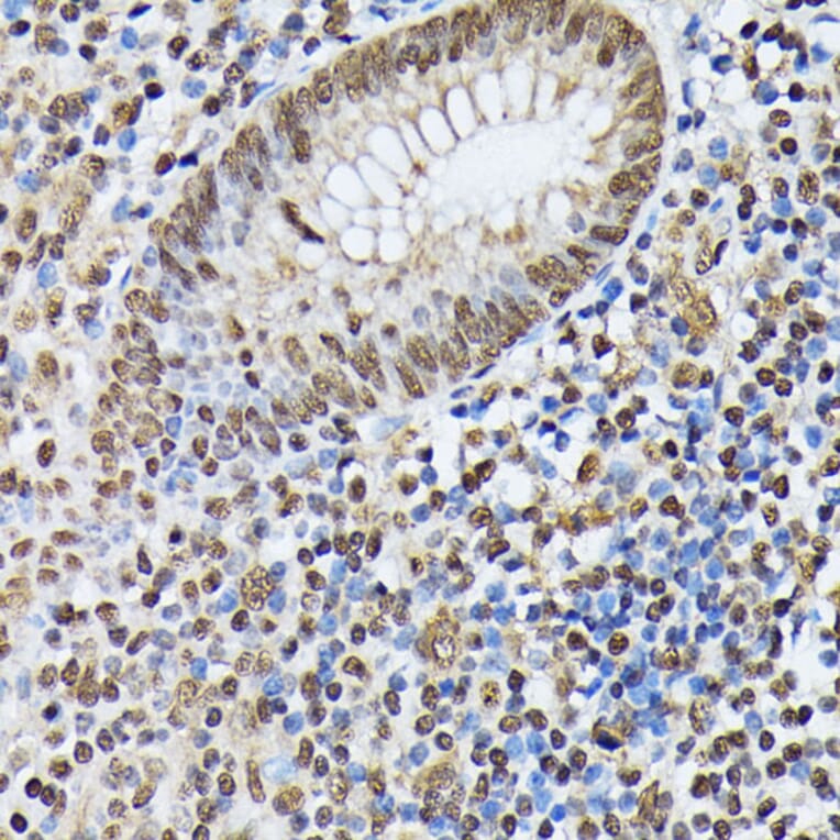 Immunohistochemistry - Anti-Heterogeneous nuclear ribonucleoprotein M Antibody (A15437) - Antibodies.com