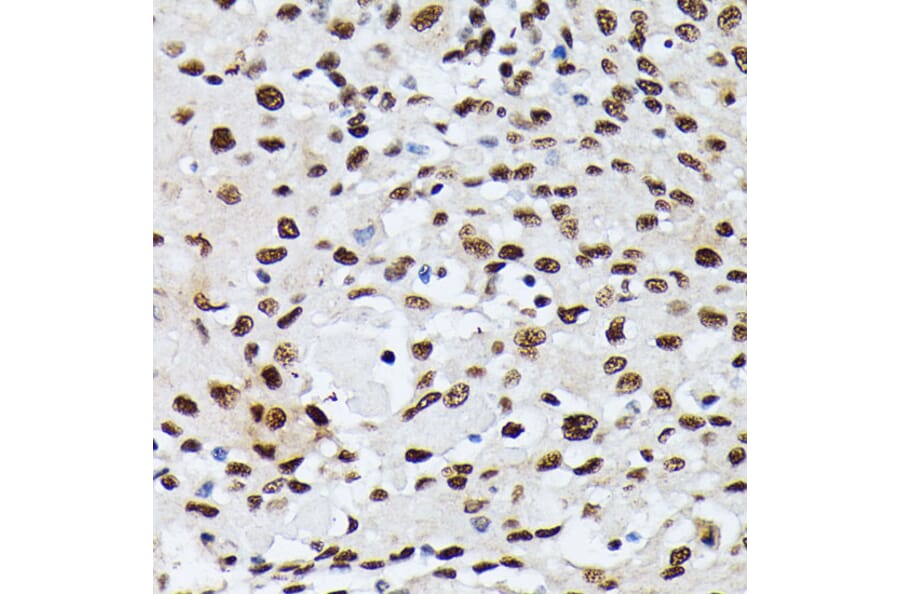 Immunohistochemistry - Anti-Heterogeneous nuclear ribonucleoprotein M Antibody (A15437) - Antibodies.com