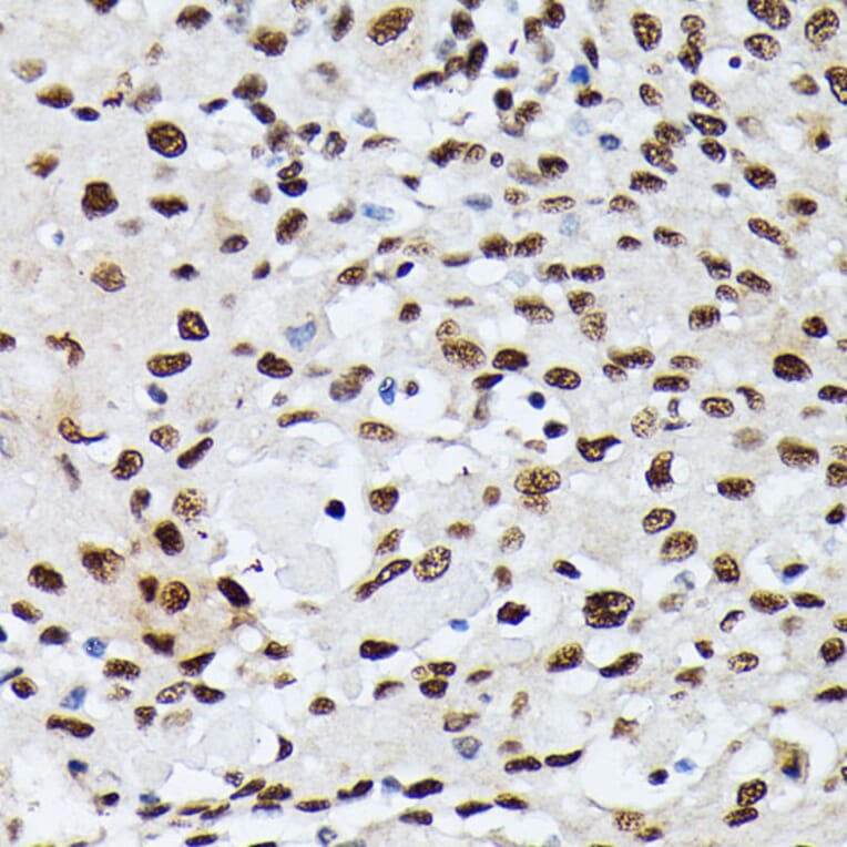 Immunohistochemistry - Anti-Heterogeneous nuclear ribonucleoprotein M Antibody (A15437) - Antibodies.com