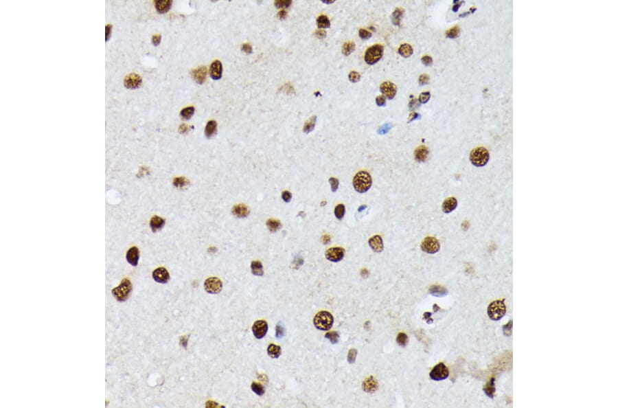 Immunohistochemistry - Anti-Heterogeneous nuclear ribonucleoprotein M Antibody (A15437) - Antibodies.com