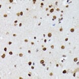 Immunohistochemistry - Anti-Heterogeneous nuclear ribonucleoprotein M Antibody (A15437) - Antibodies.com