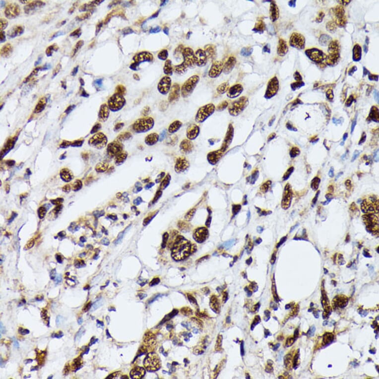Immunohistochemistry - Anti-Heterogeneous nuclear ribonucleoprotein M Antibody (A15437) - Antibodies.com