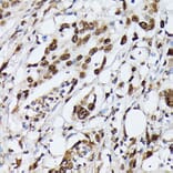 Immunohistochemistry - Anti-Heterogeneous nuclear ribonucleoprotein M Antibody (A15437) - Antibodies.com
