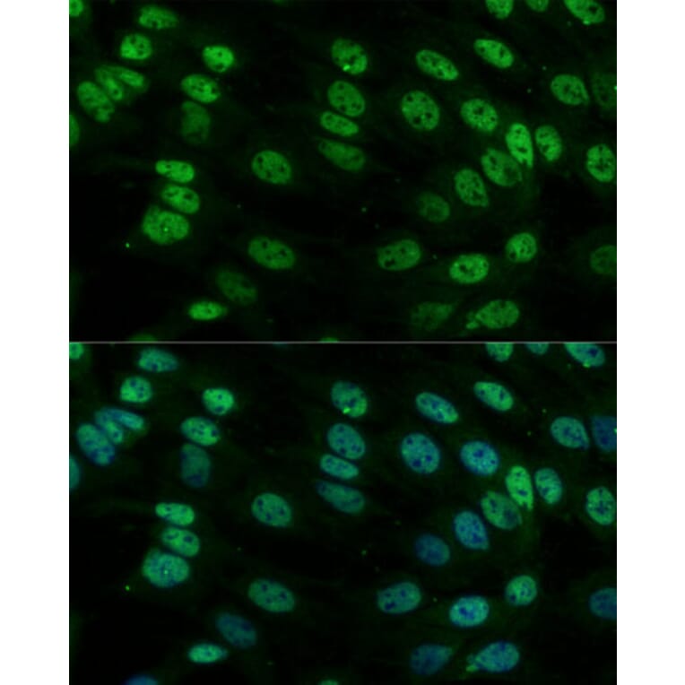 Immunofluorescence - Anti-Heterogeneous nuclear ribonucleoprotein M Antibody (A15437) - Antibodies.com