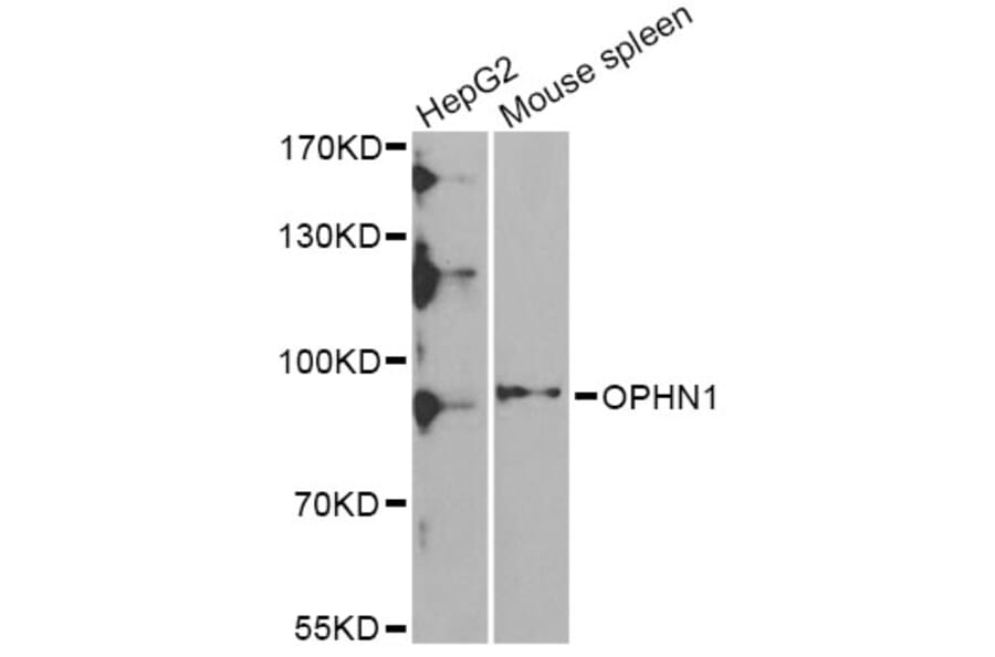 Western Blot - Anti-OPHN1 Antibody (A6940) - Antibodies.com