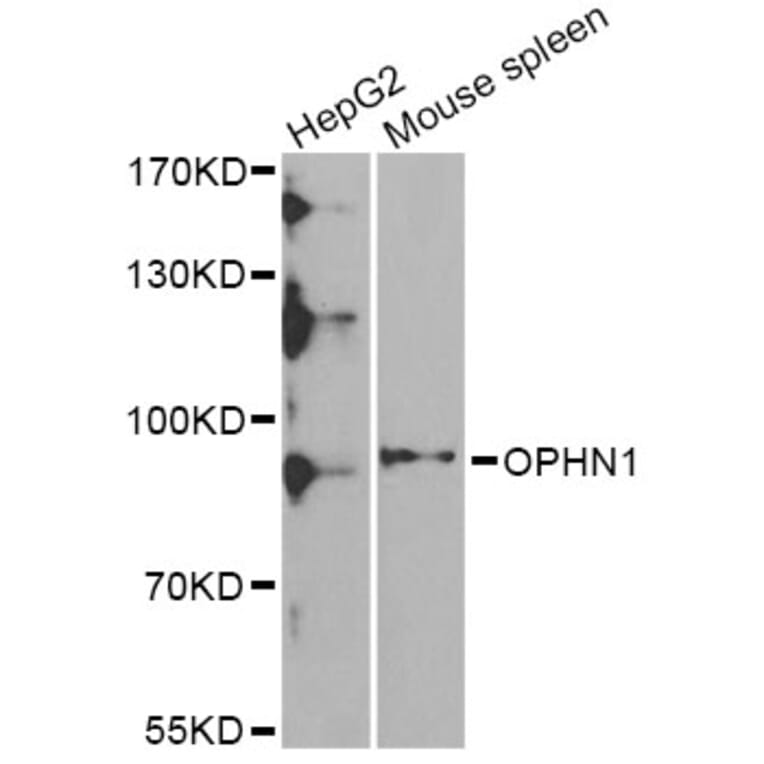 Western Blot - Anti-OPHN1 Antibody (A6940) - Antibodies.com