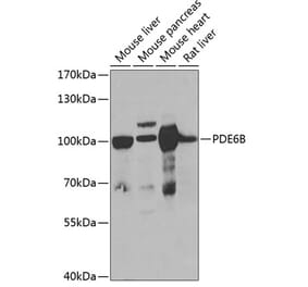 Western Blot - Anti-PDE6B Antibody (A15440) - Antibodies.com