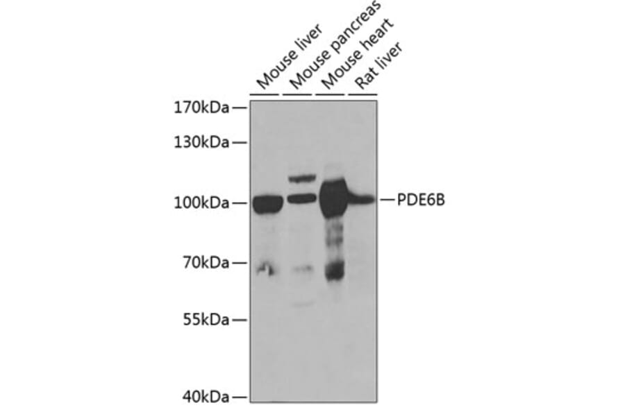 Western Blot - Anti-PDE6B Antibody (A15440) - Antibodies.com