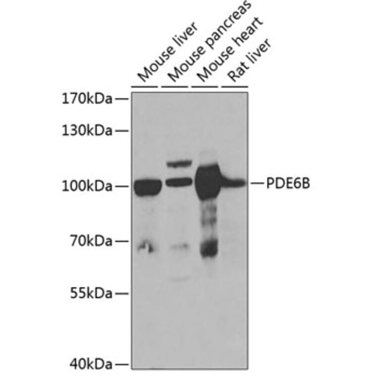 Western Blot - Anti-PDE6B Antibody (A15440) - Antibodies.com