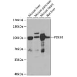 Western Blot - Anti-PDE6B Antibody (A15440) - Antibodies.com