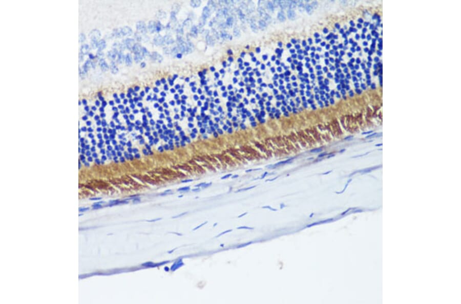 Immunohistochemistry - Anti-PDE6B Antibody (A15440) - Antibodies.com