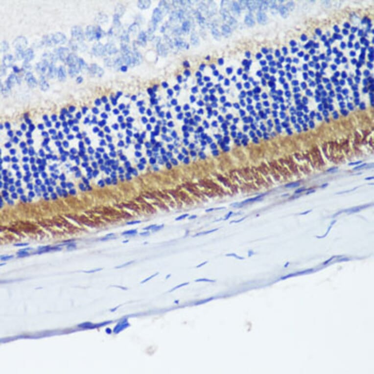 Immunohistochemistry - Anti-PDE6B Antibody (A15440) - Antibodies.com
