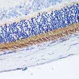 Immunohistochemistry - Anti-PDE6B Antibody (A15440) - Antibodies.com
