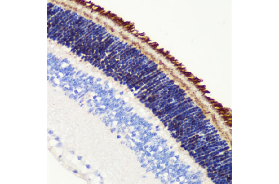 Immunohistochemistry - Anti-PDE6B Antibody (A15440) - Antibodies.com