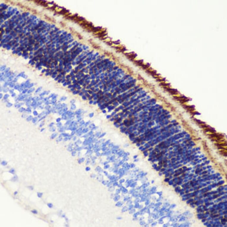 Immunohistochemistry - Anti-PDE6B Antibody (A15440) - Antibodies.com