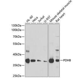 Western Blot - Anti-PDHB Antibody (A15441) - Antibodies.com