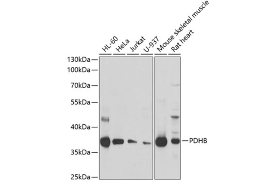 Western Blot - Anti-PDHB Antibody (A15441) - Antibodies.com