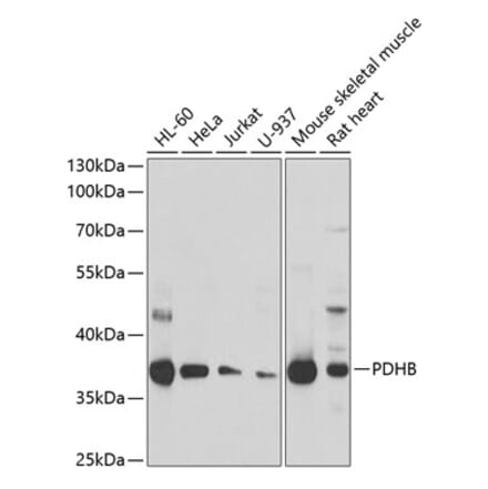 Western Blot - Anti-PDHB Antibody (A15441) - Antibodies.com