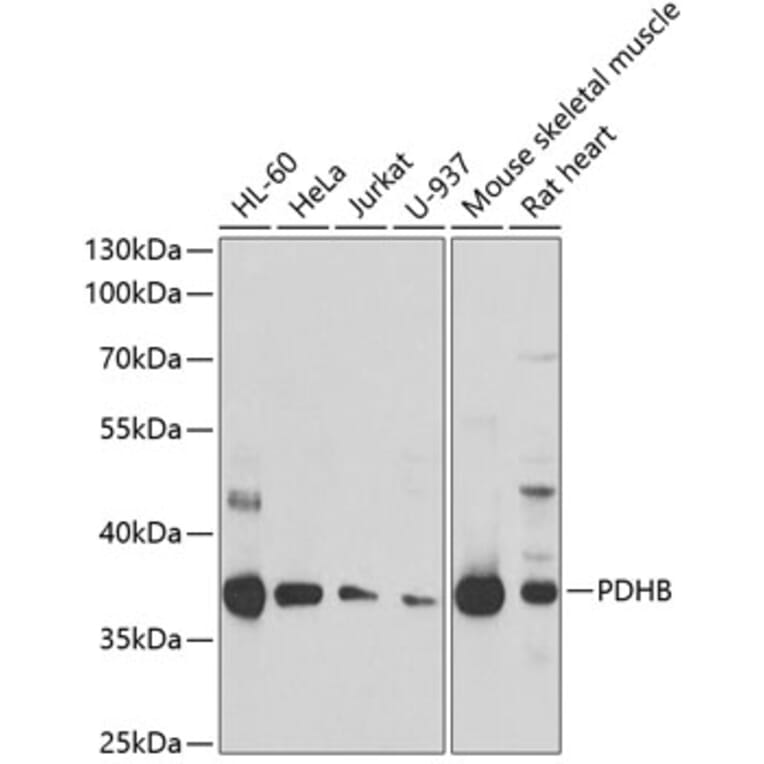 Western Blot - Anti-PDHB Antibody (A15441) - Antibodies.com