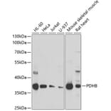 Western Blot - Anti-PDHB Antibody (A15441) - Antibodies.com
