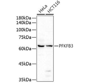 Western Blot - Anti-PFKFB3 Antibody (A15442) - Antibodies.com