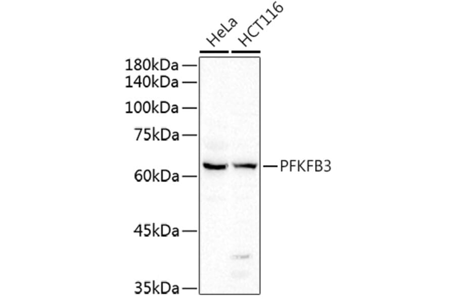 Western Blot - Anti-PFKFB3 Antibody (A15442) - Antibodies.com