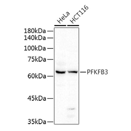 Western Blot - Anti-PFKFB3 Antibody (A15442) - Antibodies.com