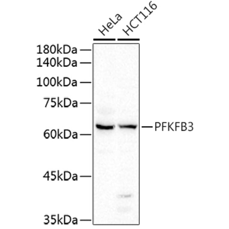 Western Blot - Anti-PFKFB3 Antibody (A15442) - Antibodies.com