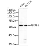 Western Blot - Anti-PFKFB3 Antibody (A15442) - Antibodies.com